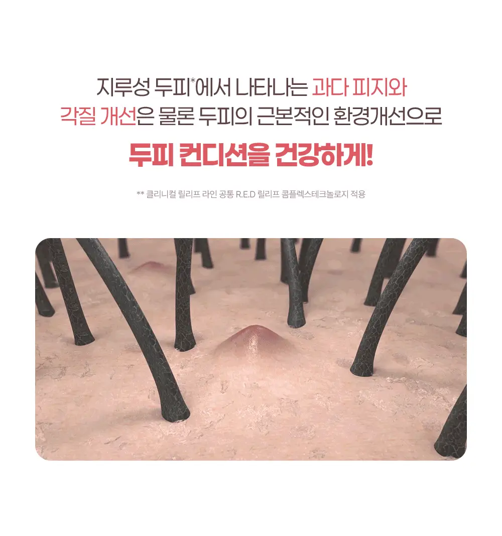 [지루성두피 5대 문제 개선] 닥터그루트 클리니컬 릴리프 지루성두피용 샴푸 350ml 상세페이지 13